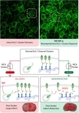 Anthony Schulien’s Exciting Neuroscience Discovery